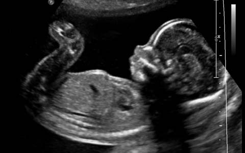 Ginekološka Ordinacija - Trion Medical - Ekspertni ultrazvučni pregled