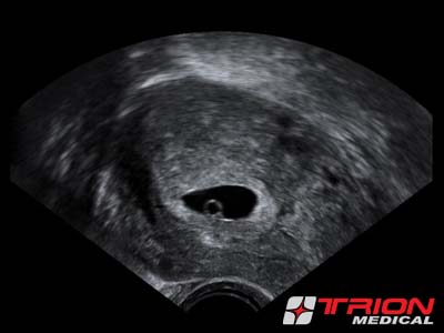 Ginekološka Ordinacija - Trion Medical - Savremeno praćenje trudnoće
